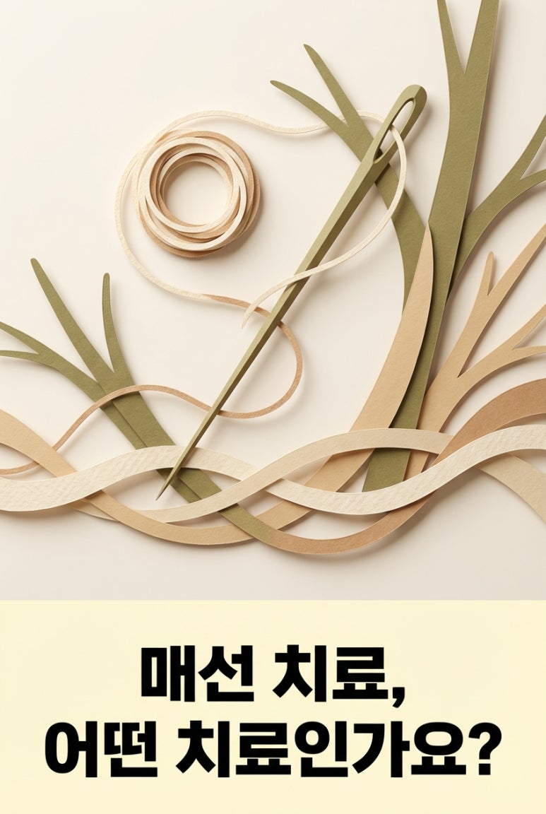 매선 치료, 어떤 치료인가요?